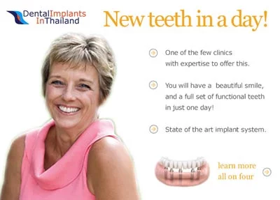 dental-implants-thailand-debbie-before-after