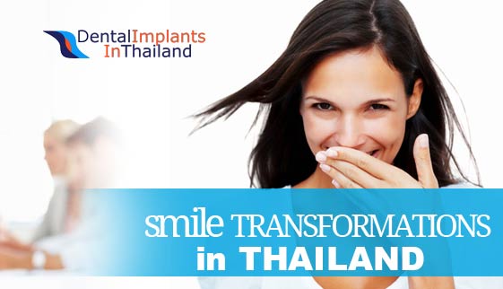 amazing-thai-smile-makeover-bangkok-before-after-pictures