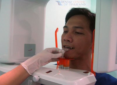dental-thailand-xray-james