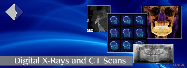 digital-xrays-imaging-ct-scans