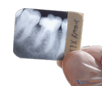 photo-Dental-xray