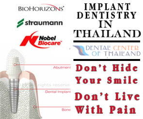 Dental-Implants Center-Bangkok
