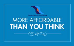 Most Affordable than you think